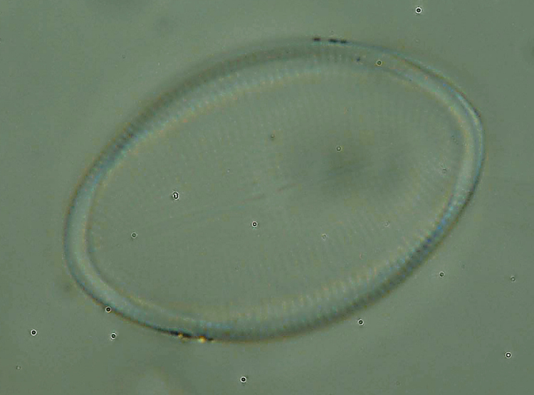 Cocconeis pediculus?